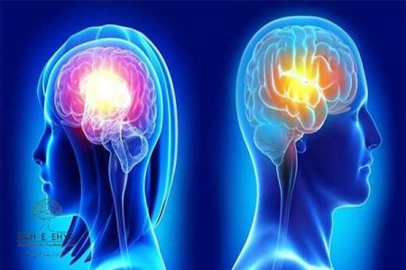 آلزایمر و رسوب آمیلویید در مغز